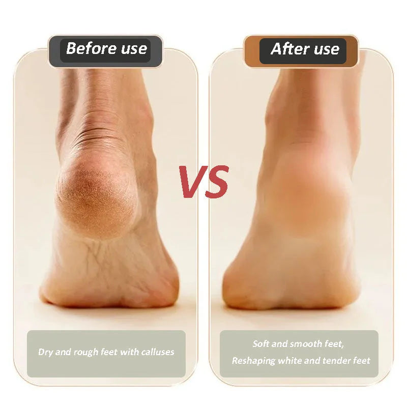 2025 New USB rechargeable foot repair and grinding device